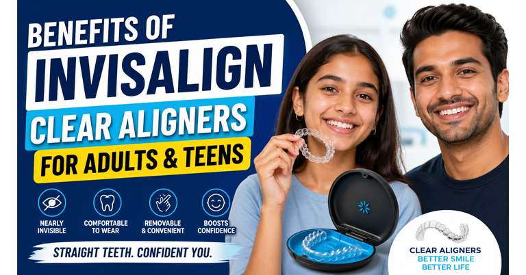 Benefits of Invisalign clear aligners